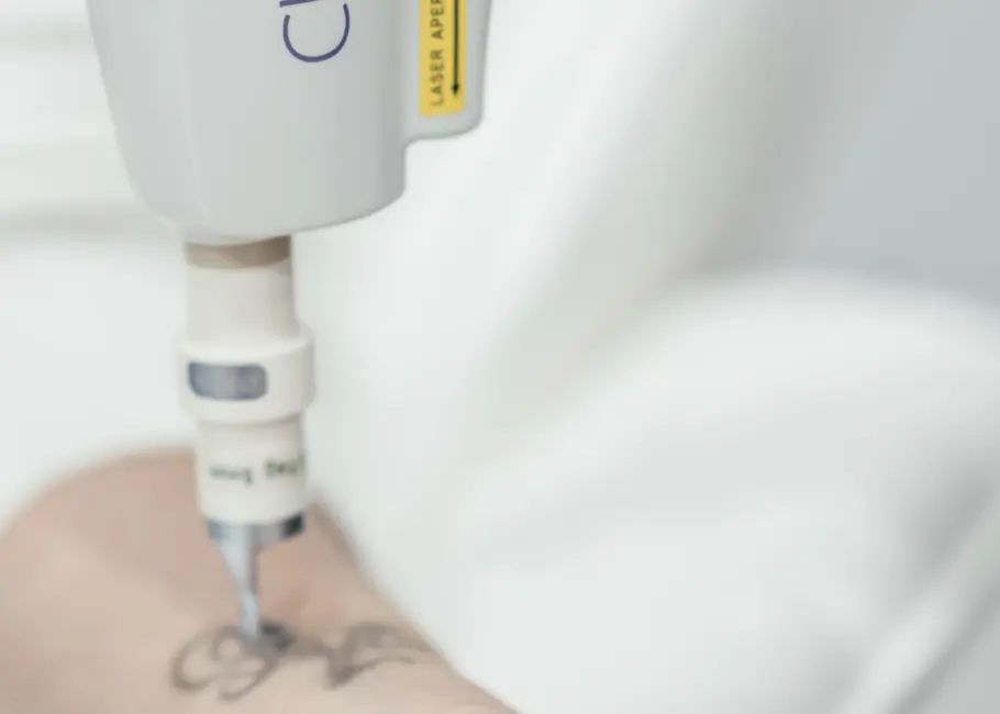 HARMONY XL PRO™ Tattoo Removal