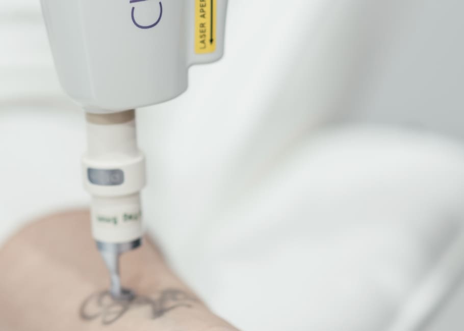 HARMONY XL PRO™ Tattoo Removal